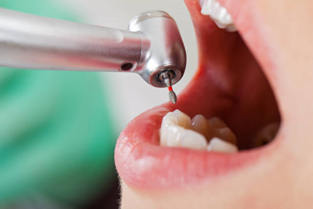 Best Emergency Dental Care for Broken or Chipped Teeth in Walnut, IL